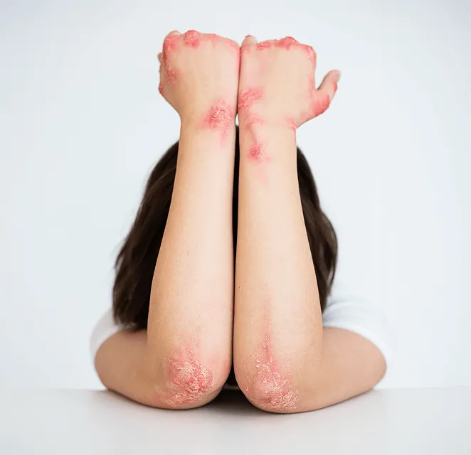 Before using our product